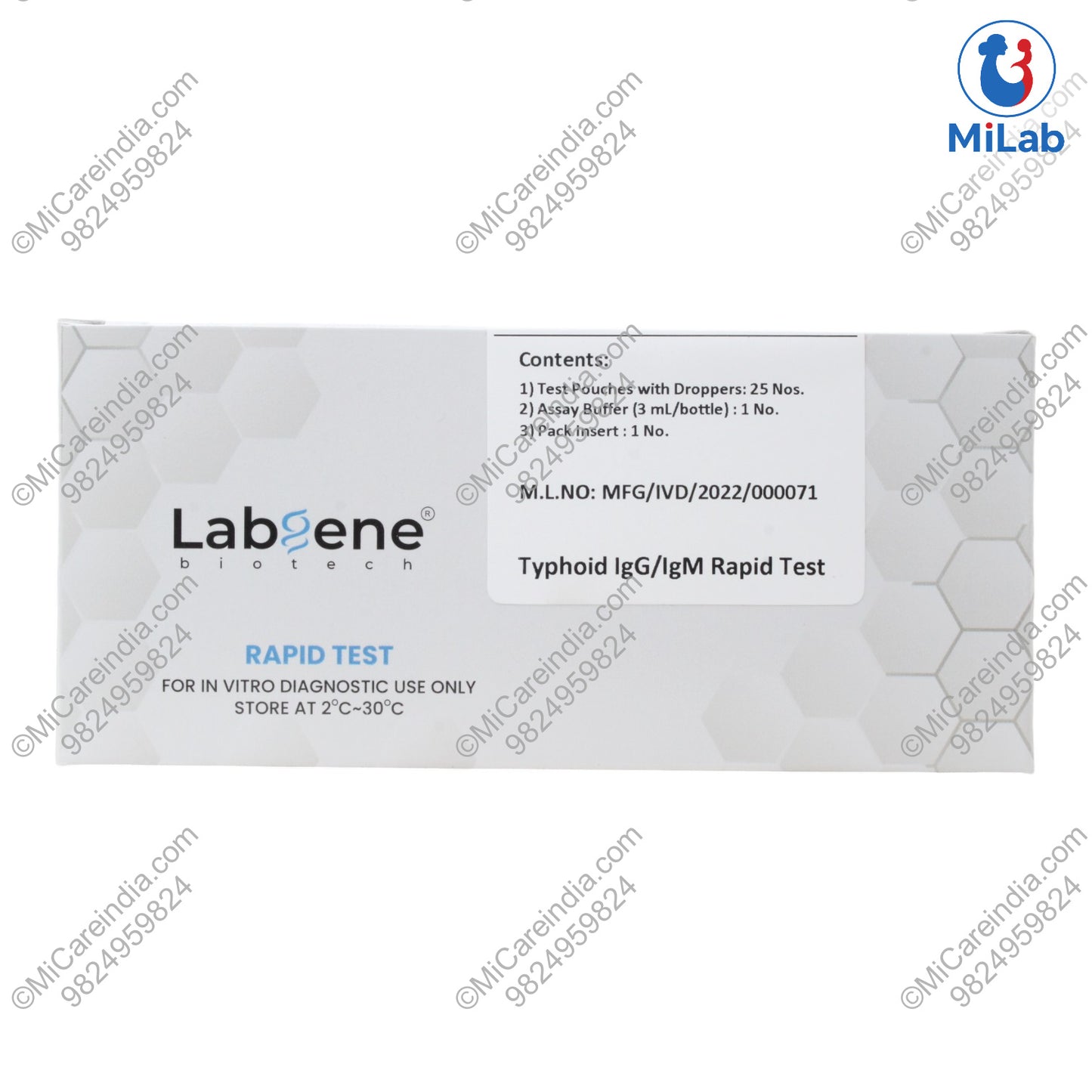 TYPHOID IGG/IGM 25 TEST KIT