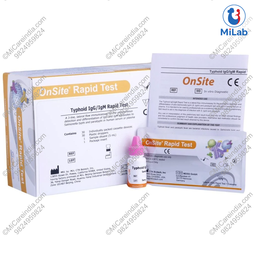 TYPHOID IGG/IGM CTK 30 TEST KIT
