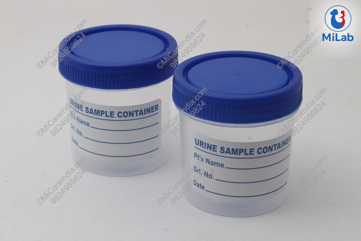 URINE CONTAINER UNSTERILE 30ML (PACK OF 100)