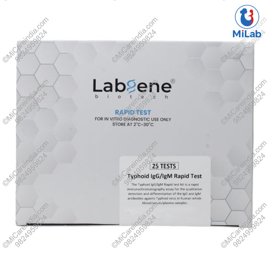 TYPHOID IGG/IGM 25 TEST KIT