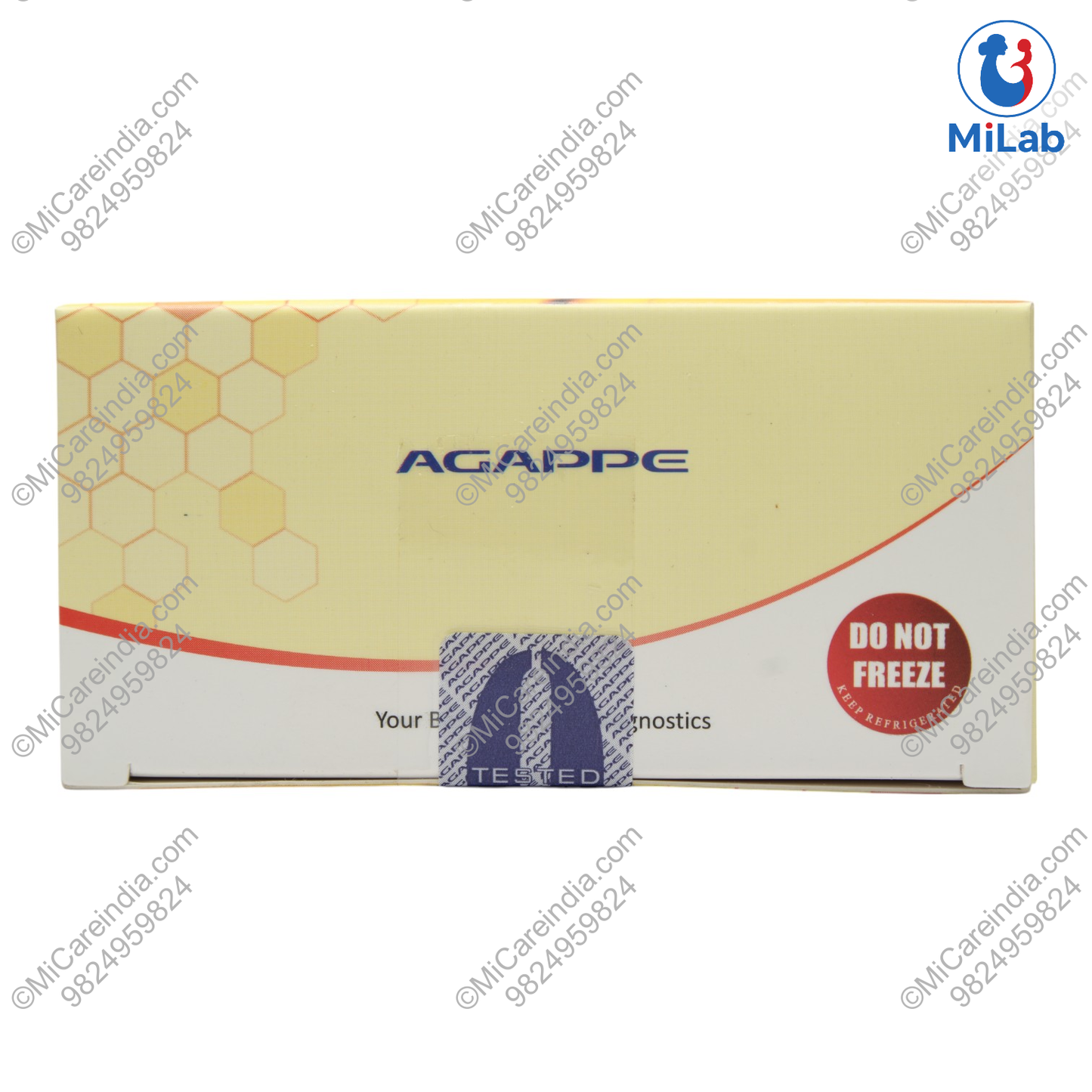 Agappe Mispa i2 CRP Kit (30 Tests)