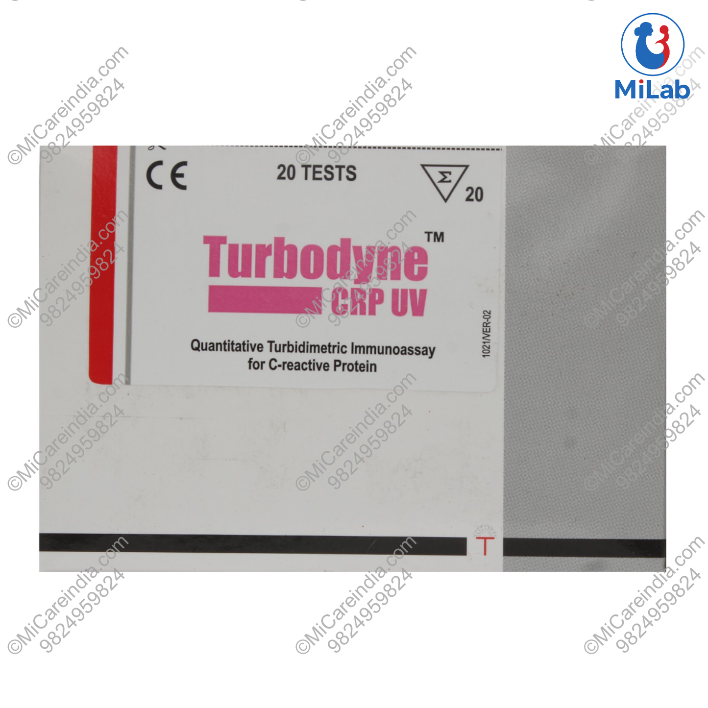 Tulip Turbodyne CRP UV Kit (20 Tests)